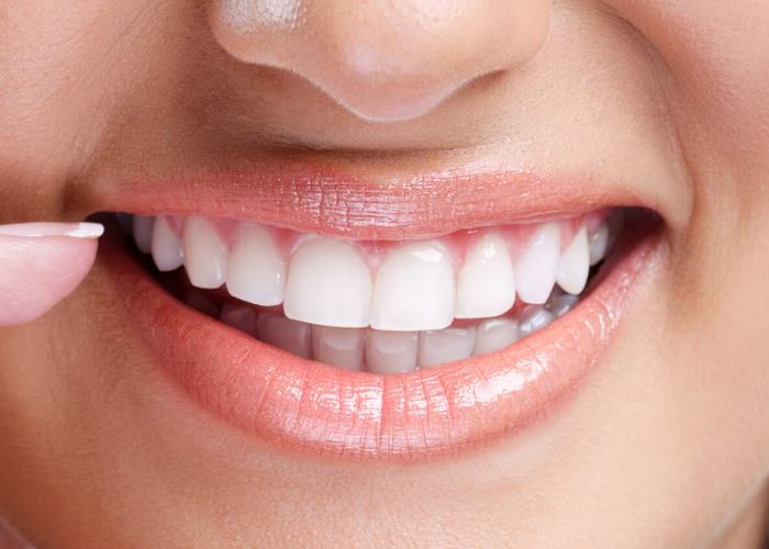 From Crooked to Confident: How Cosmetic Dentistry Can Transform Your Smile From Crooked to Confident